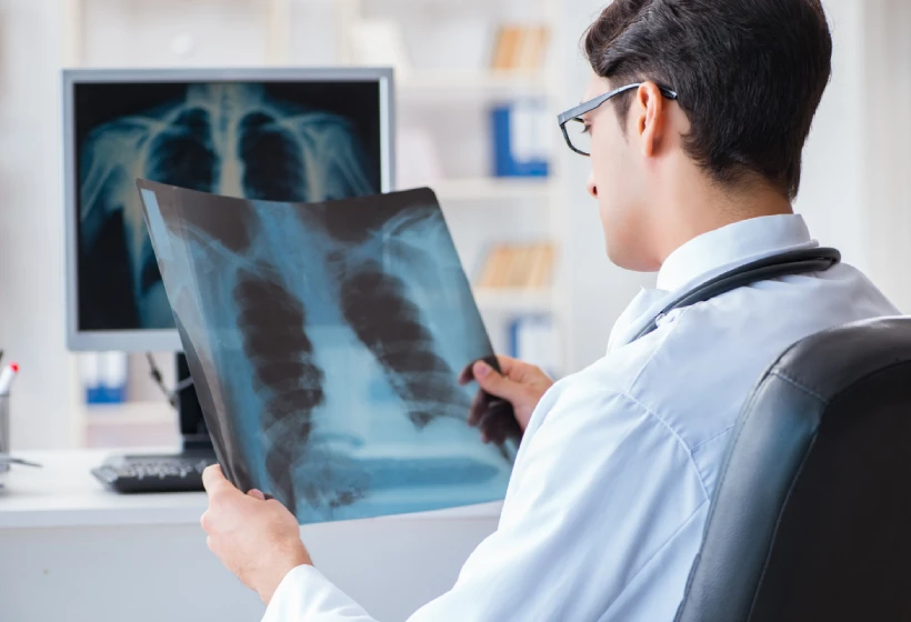 Doctor examining chest x-ray